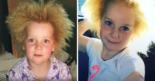 10-Year-Old Girl With Genetic Condition Loves Her Fuzzy Hair