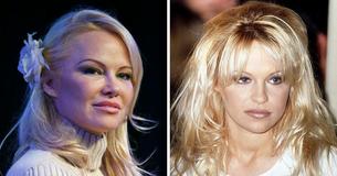 Pamela Anderson Hasn't Been Lucky In Love: She Has Endured Remarriages, Divorces & Annulments
