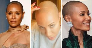 Jada Pinkett Smith's Alopecia Left Her 'Shaking With Fear' At First But Today She Is 'Friends' With It