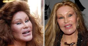 Inside The Life Of Jocelyn Wildenstein, The Billionaire Socialite Known As ‘Catwoman’