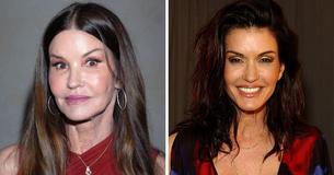 Supermodel Janice Dickinson Says ‘I Live For Plastic Surgery’ But Denies Having Some Procedures Done