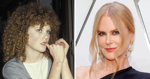 Nicole Kidman No Longer Does Botox But Doesn't 'Judge' Others For Their Beauty Routines