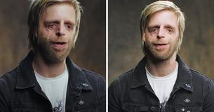 Man Put Up For Adoption As A Newborn Due To His Looks Is Inspiring Others Just Like Him