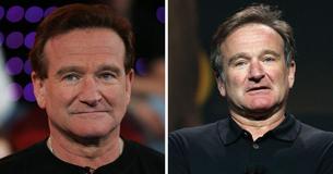 Robin Williams’s Undiagnosed ‘Chemical Warfare’ In His Brain Caused Him Immense Anguish