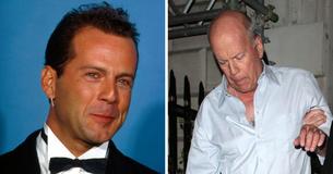 La familia de Bruce Willis asumió su cuidado cuando empezó a tener problemas para actuar