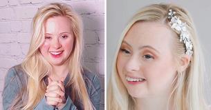 Bullied Woman With Down Syndrome Persevered And Is Now The Face Of Fashion Campaigns