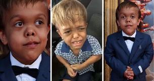 Bullied For His Dwarfism, Quaden Bayles Is Now A Red Carpet Star
