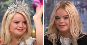 Trailblazing Model With Down Syndrome Becomes Face Of Makeup Brand Campaign