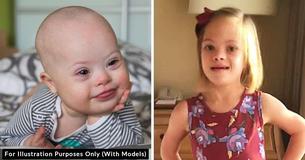 Girl With Down Syndrome Left By Parents At Birth Becomes An Actress & Will Star In New ‘Hunger Games’ Film