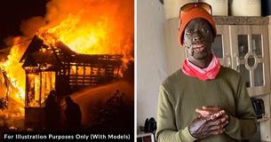 Local Superhero Rushed Into Burning Home To Rescue 2 Kids And Ended Up With Major Burns, Says He'd Do It Again