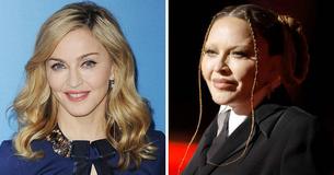 Fans sind traurig über das, was Madonna sich selbst angetan hat und fordern sie auf, mit Würde zu altern