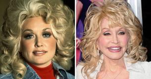 Dolly Parton, 77, Says Age ‘Shouldn’t Matter’ As She Gets Candid On Aging