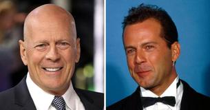 Un cineasta revela que el deterioro de la salud de Bruce Willis fue obvio durante años antes de retirarse