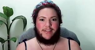 Una madre que solía ocultar su vello facial ahora muestra su barba con toda confianza