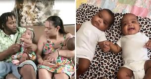 Parents Throw Baby Shower For Their Formerly Conjoined 6-Month-Old Twins To Celebrate Being ‘Home With Family’