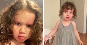 Une mère dévouée aide sa petite fille critiquée pour son visage « hideux » à embrasser ses différences « magnifiques »