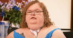 Nuevas fotos revelan que Tammy, la estrella de "Las hermanas de 300 kilos", ha avanzado en su camino de pérdida de peso sin ayuda de oxígeno