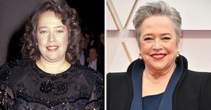 Kathy Bates Shocks Fans While Promoting ‘Matlock’ After Huge Drop In Weight Left Her With Unrecognizable ‘Thin’ Face