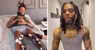 Man Spends $81K On Limb-Lengthening Procedure After Feeling ‘Inferior’ From Crush Rejecting Him