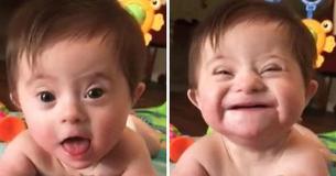 Mom Captures Video Of Her Adopted Baby Girl With Down Syndrome Flashing Her ‘New Smile’