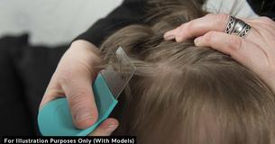 Upset Mom Reveals How Vegan Neighbor Refuses To Treat Her Daughter’s Head Lice Infestation