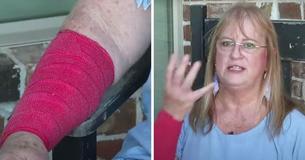 Woman Incurs Injuries After Snake Wraps Onto Her Arm Before Hawk Swoops Down For Its Prey