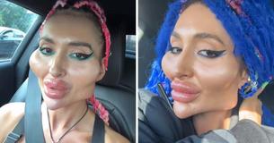 Fans Express Concern About Model & Say Her Extreme Look Proves She ‘Needs Help’