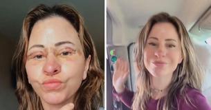 Frau verkauft Haus und lebt in einem Van, um 14.000 Dollar für eine Gesichtsstraffung "zu stemmen", die sie jünger aussehen lässt
