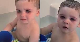 Mom Warns Parents About Bath Toys After Her Baby Nearly Lost His Sight