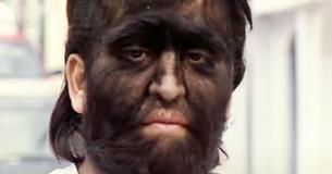 ‘The Wolf Man’ Who Had To Work In The Circus For Years Decided To Shave His Face And Look For Regular Jobs To Feed His Family