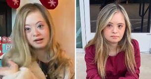 Defying All Odds: Young Woman With Down Syndrome Becomes Model, Motivational Speaker & Defeats Cancer