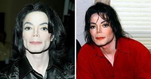 Michael Jackson’s Tragic Autopsy Report Revealed Sad Truths And The Cause Of His Death