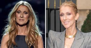 Céline Dion's 'Puffy' Appearance At The Grammys Puzzled Fans After She Was 'Painfully Thin' In the Last Years
