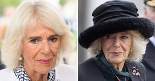 Queen Camilla’s Various Health Woes Include Falling In A Hole & Suffering A Broken Leg