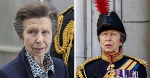 At 73, Princess Anne Admitted To Hospital With Concussion After Frightful ‘Incident’ At Home