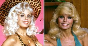 Fans Urge ‘70s Television Icon To ‘Stop Doing’ Cosmetic Surgery That’s Turning Her Into A ‘Cartoon Character’