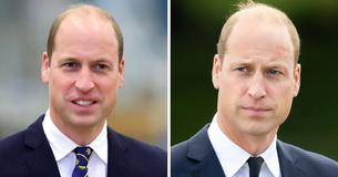 Prince William Slammed For His 'Ridiculous' Outfit At Event Alongside Chic Celebrities