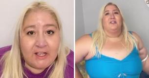 Woman With Medical Disorder Body-Shamed Over Enlarged Legs Fires Back At Critics Who Have No Right To ‘Point And Laugh’