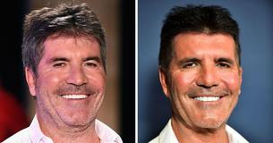 Simon Cowell Admits He Went ‘A Bit Too Far’ With Botox And Fillers But Stopped When He Could Barely Recognize Himself