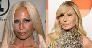 Donatella Versace Left Fans Speechless With Her Youthful ‘New Face’ During Animal Shelter Visit