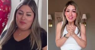 Woman Who Lost 117 Pounds Criticized For Being ‘Too Thin’ & ‘Not Attractive’ Urges People To ‘Stop Judging’