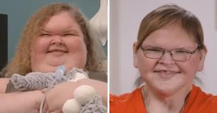 ‘1000 Lbs Sisters’ Star Tammy Slaton Looks ‘Unreal’ After Getting Excess Skin Removal She ‘Worked Really Hard’ For