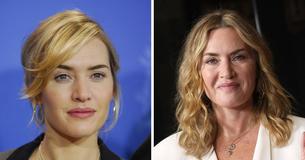 Kate Winslet Reveals the Real Reason Why She Isn’t Getting Any Cosmetic Surgeries