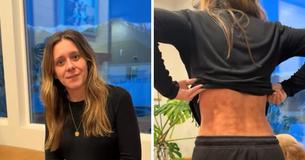 Kvinnans sexåriga ”beroende” av värmedyna gav långvariga hudskador
