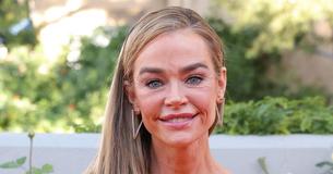 Denise Richards Revealed Her New Face After ‘Terrifying’ Surgeries & Why It Was The ‘Best Thing’ For Her