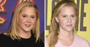 Amy Schumer Opens Up About The Journey Behind Her 'No Filter' Summer Photos