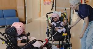 Twin Sisters Successfully Separated After One Of America’s Most Complex Pediatric Surgeries