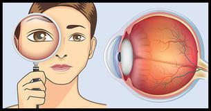 Improve Your Eyesight Without Glasses With These 4 Exercises