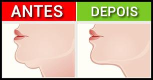  7 Exercícios Eficazes Para Reduzir um Queixo Duplo e Parecer Mais Jovem 