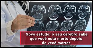 Estudo arrepiante revela que os nossos cérebros são auto conscientes depois de morrermos
